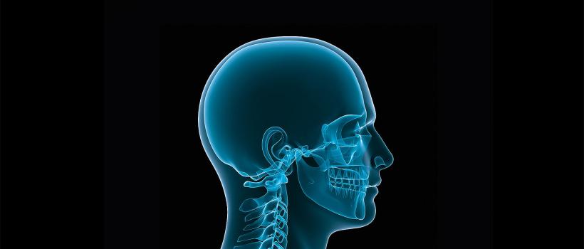 Craniomaxillofacial (CMF) Devices And Equipment Market Share, Restraints, Segments And Regions