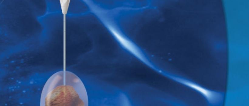 Cryoablation Devices 