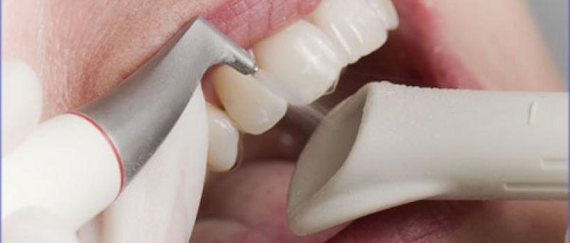 Dental Biomaterials, Dental Biomaterials Market, Dental Biomaterials Market Growth