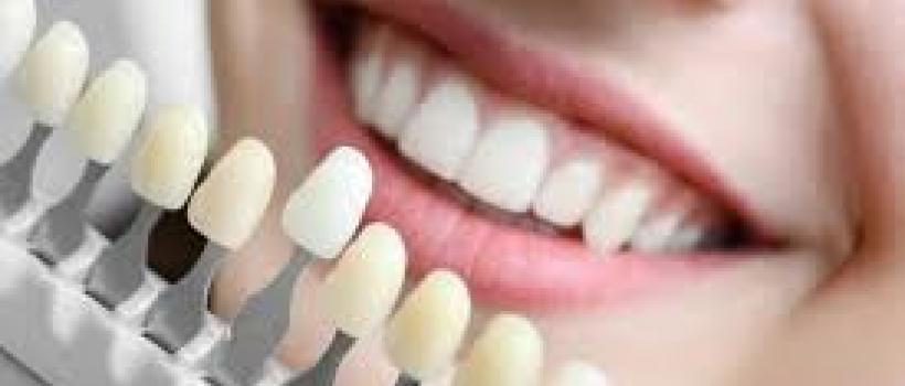Dental Implants Market