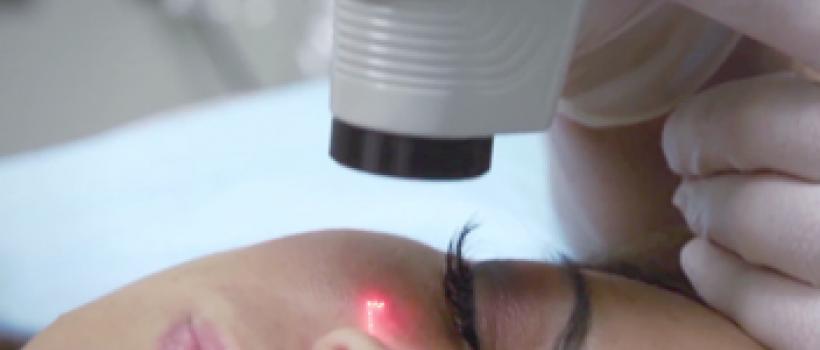  Dermatology Lasers