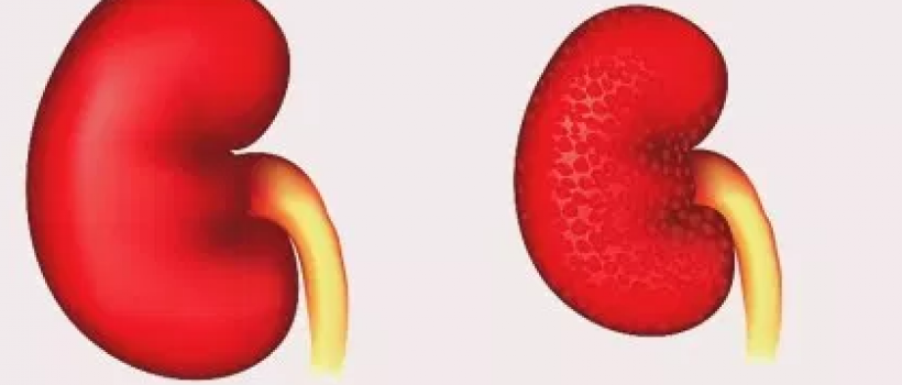 Diabetic Nephropathy Market