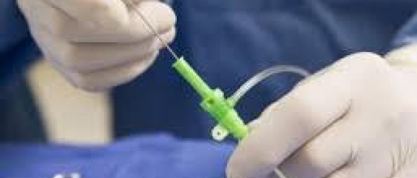 Diagnostic Electrophysiology (EP) Catheters Industry