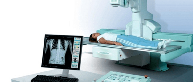 Digital Fluoroscopy Systems