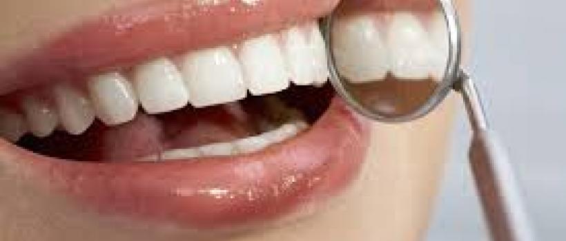 Direct Restorative Materials of Dental Consumables
