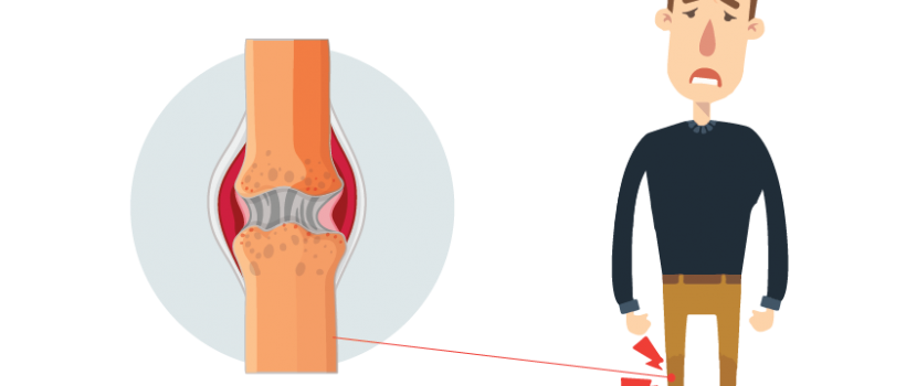 ArthritisTreatmentCenterNagpur, RheumatoidArthritisSymptoms, WhatCausesArthritis ,RheumatoidArthritisTreatmentNagpur , RheumatoidArthritisMedicationsNagpur ,ArthritisRemediesNagpur,AyurvedicTreatmentArthritisNagpur ,AyurvedicTreatmentKneePainSwellingNagpur , AyurvedicTreatmentKneeArthritisNagpur, RheumatoidArthritisNaturalTreatmentNagpur, AchillesTendonInjuryTreatmentNagpur, AchillesTendonitistreatmentNagpur,AchillesTendonPainTreatmentNagpur , AchillesHeelPainNagpur, AyurvedicTreatmentMeniscusTearNagpur, Me