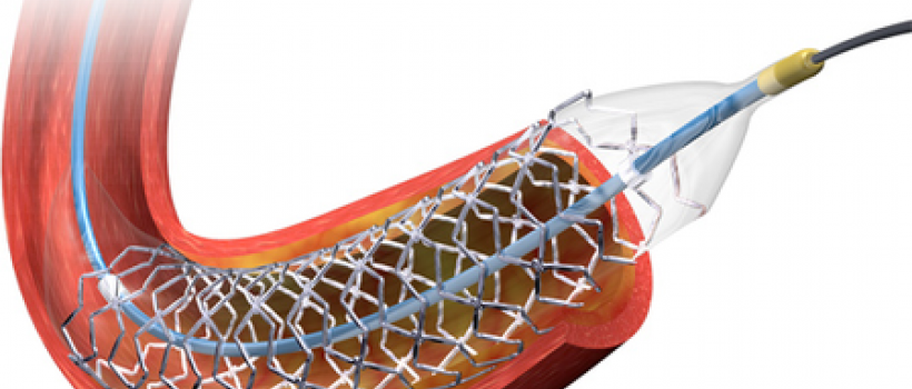 Drug Eluting Stents Market