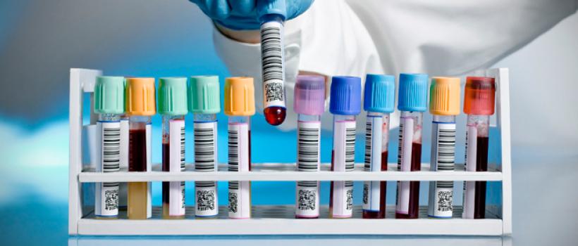 Drug Testing Market