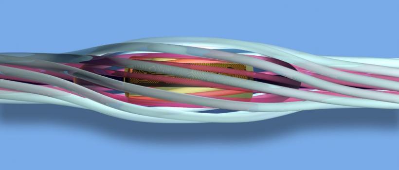 E-textile 