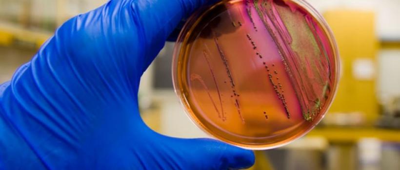 E. Coli Testing Market