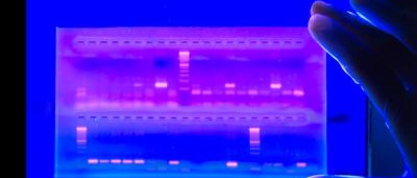 Electrophoresis