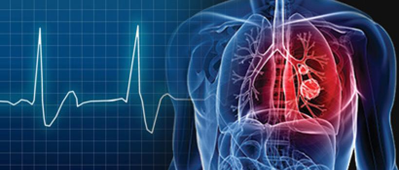 Electrophysiology