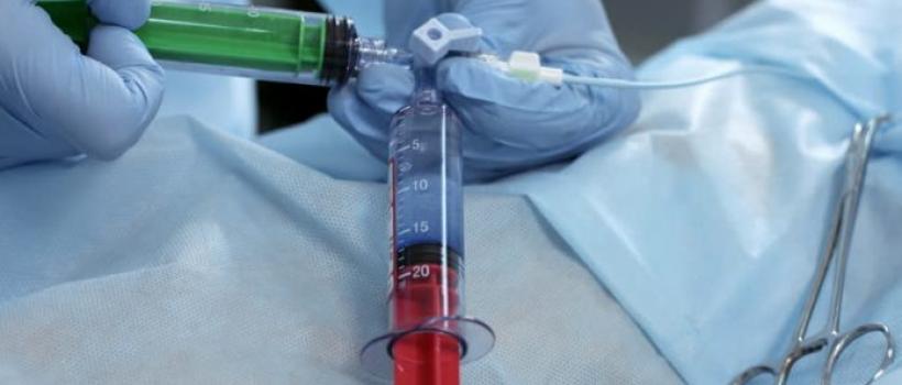 Embolization Particl