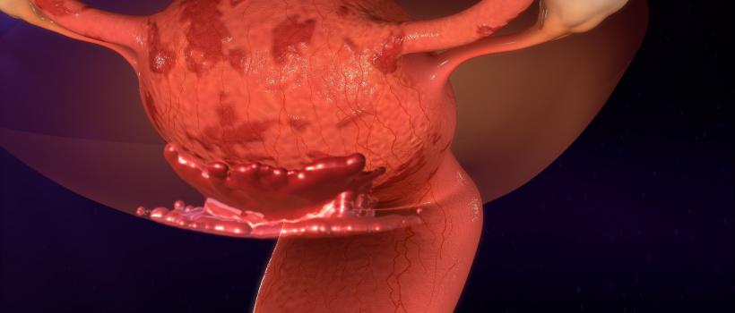 Endometriosis Treatment Market