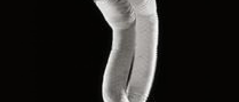 Endovascular Aneurysm Repair (EVAR) Market