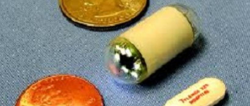 Esophageal Video Capsule Endoscopy