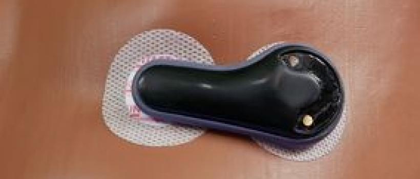 External Pacemakers Industry
