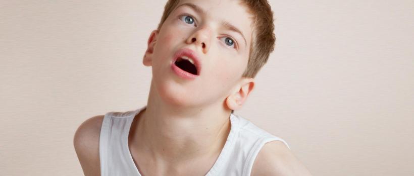 Global Acute Dystonia Market