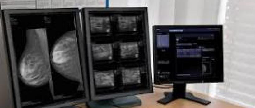 Global Advanced (3D/4D) Visualization Systems Sales Market Report 2017