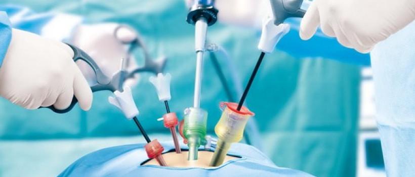 Global Laparoscopy Devices Market 2025