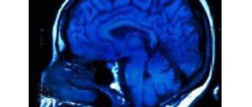 Global X-Ray Contrast Agents Sales Market Report 2017