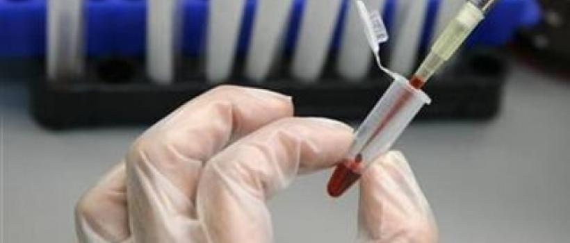 HIV/AIDS Diagnostics