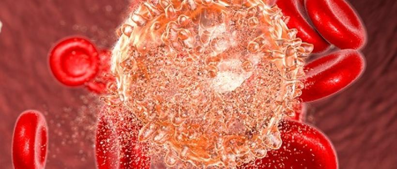 Hematologic Malignancies 