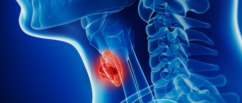 Hodgkins Lymphoma Treatment 