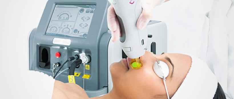 Home Laser Hair Removal Industry