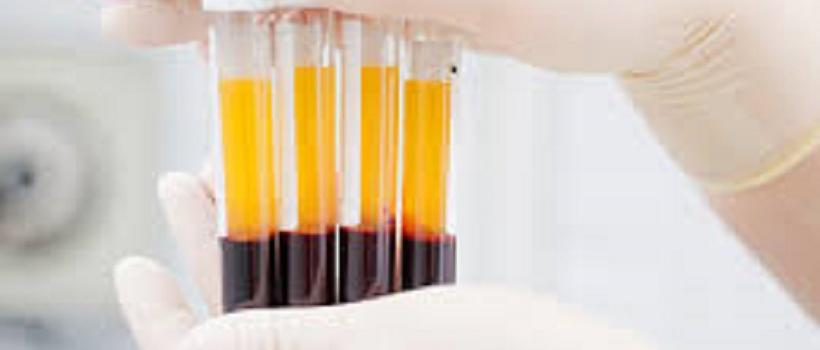 Human Plasma-Derived Therapeutics