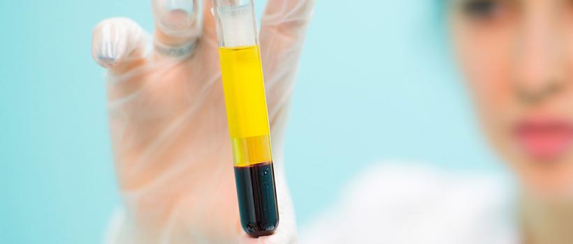 Human Platelet Lysate Market