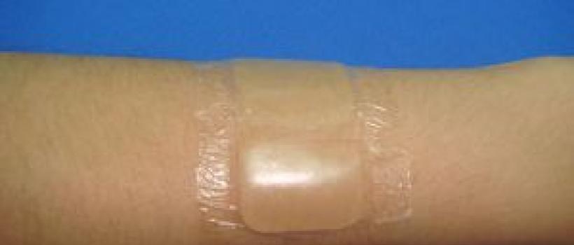 Global Hydrogel Dressing Market Research Report 2017-2022