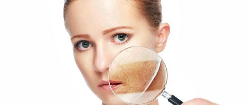 Hyperpigmentation Disorders Treatment Market