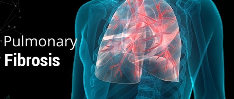 Idiopathic Pulmonary Fibrosis (IPF) Treatment Market 