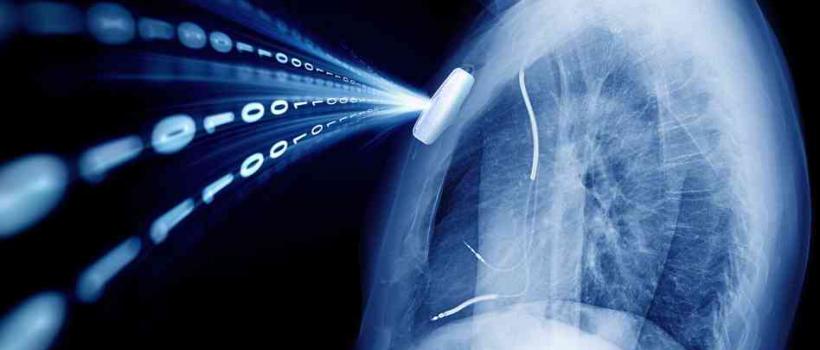 Implantable Medical Devices, Implantable Medical Devices Market, Implantable Medical Devices Market Growth,  	implantable medical devices companies, implantable medical devices definition