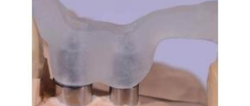 Industry Dynamic Analysis of Asia-Pacific Free Radical Light Curing Resin Market Report 2018