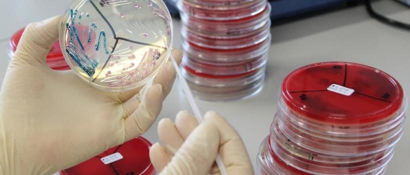 Infectious Disease Diagnostics
