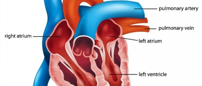 Inferior Vena Cava (IVC) Filters