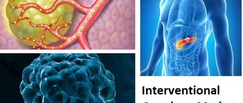 Interventional Oncology Market