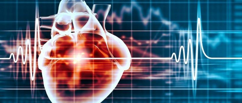 Intravascular Temperature Management Sys