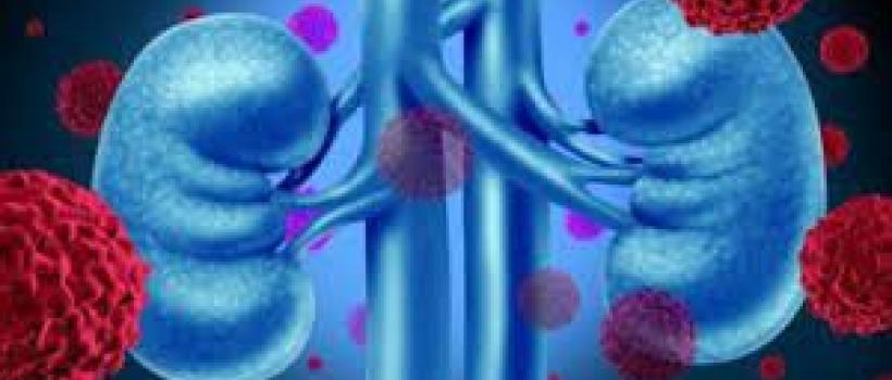 Kidney Cancer Drugs Market