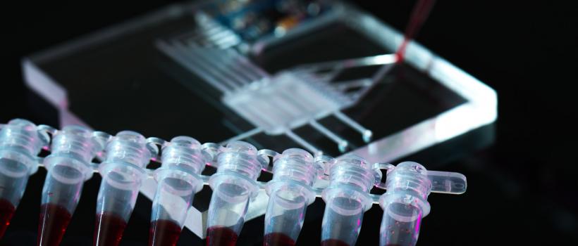 Lab-on-a-chip