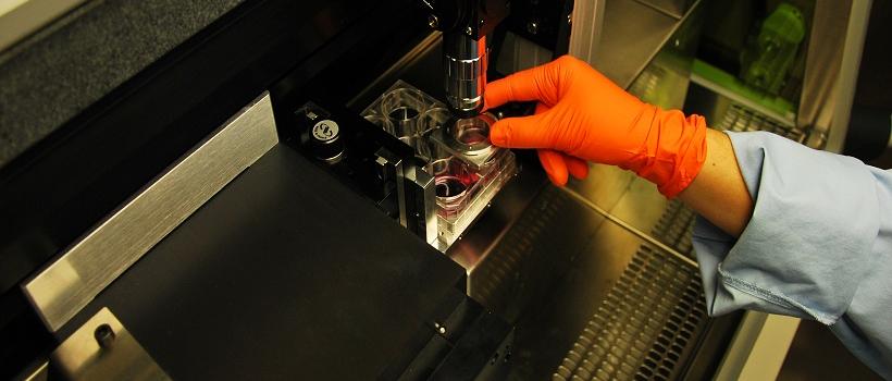 Laser-based 3D Bioprinting, Laser-based 3D Bioprinting Market, Laser-based 3D Bioprinting Market Growth