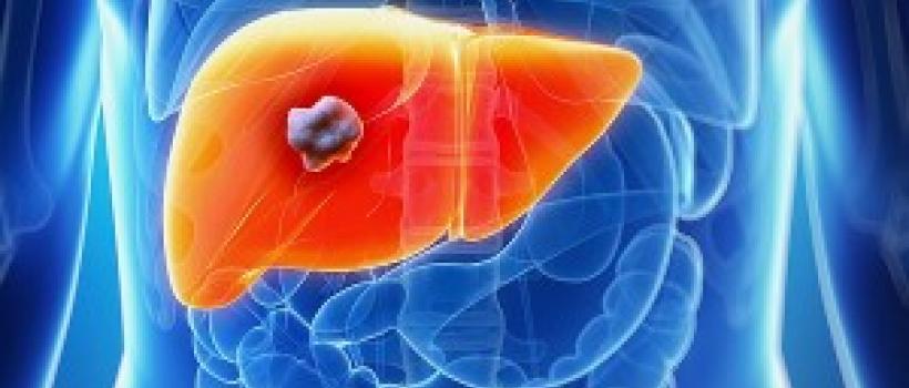 Global Liver Cancer Therapeutics Market