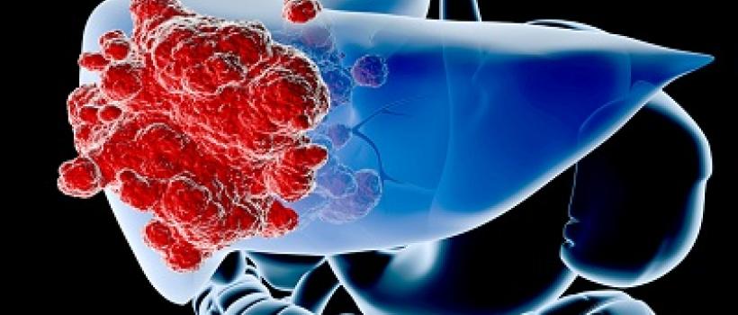Liver Cirrhosis Therapeutics