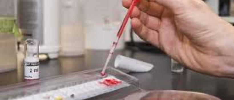 Lyme Disease Diagnostics