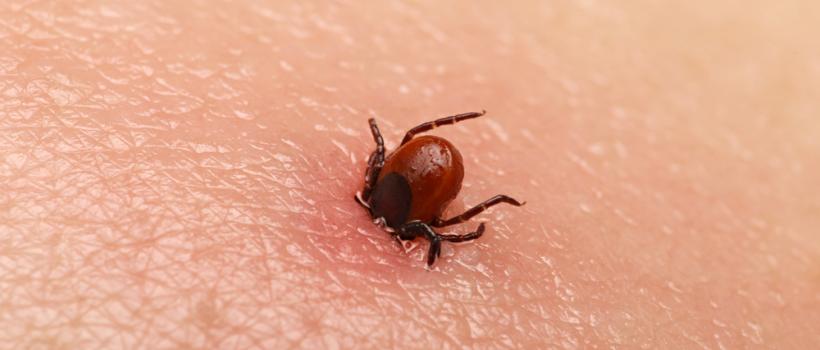 Lyme Disease Treatment