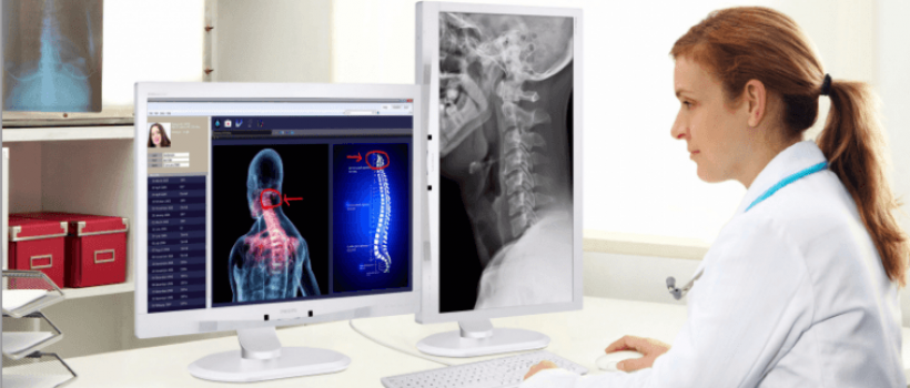 Medical Imaging Displays Market Size 