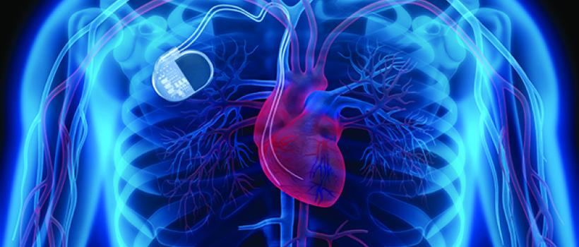 Medical Implant Market
