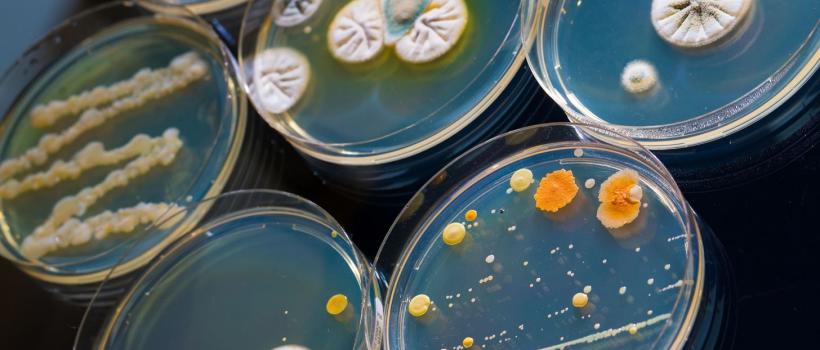 Microbial API Market